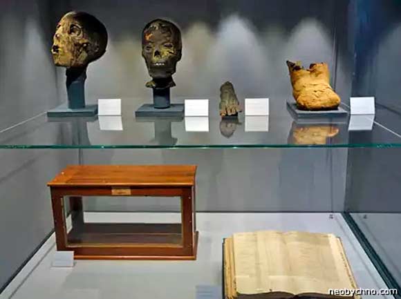 Привезенные из разграбленных усыпальниц Египта мумии вызвали фурор в мире здравоохранения